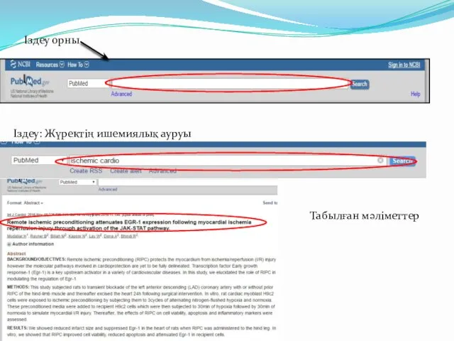 Іздеу орны Іздеу: Жүректің ишемиялық ауруы Табылған мәліметтер