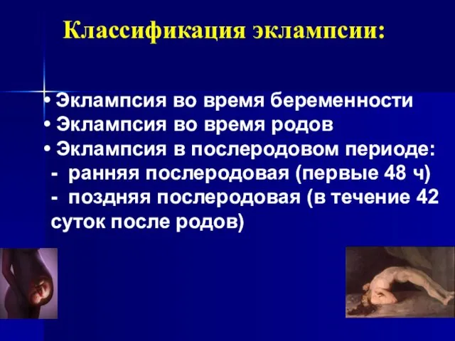 Классификация эклампсии: Эклампсия во время беременности Эклампсия во время родов Эклампсия