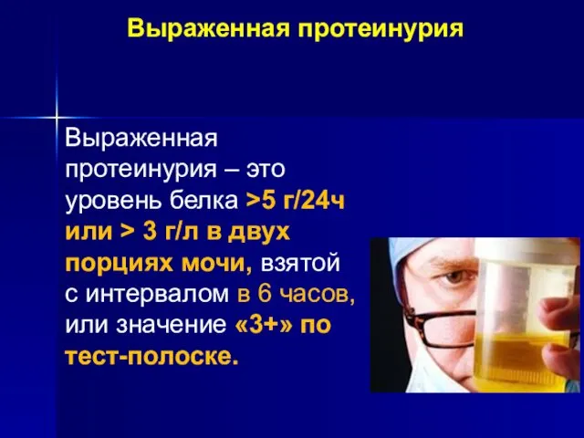 Выраженная протеинурия Выраженная протеинурия – это уровень белка >5 г/24ч или