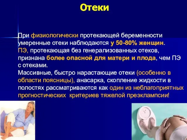 Отеки При физиологически протекающей беременности умеренные отеки наблюдаются у 50-80% женщин.