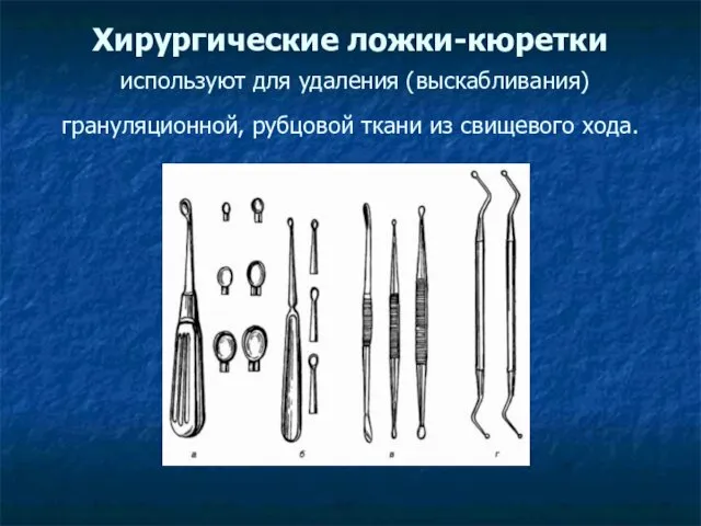 Хирургические ложки-кюретки используют для удаления (выскабливания) грануляционной, рубцовой ткани из свищевого хода.