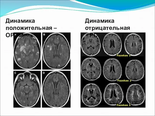 Динамика положительная – ОРЭМ Динамика отрицательная - РС