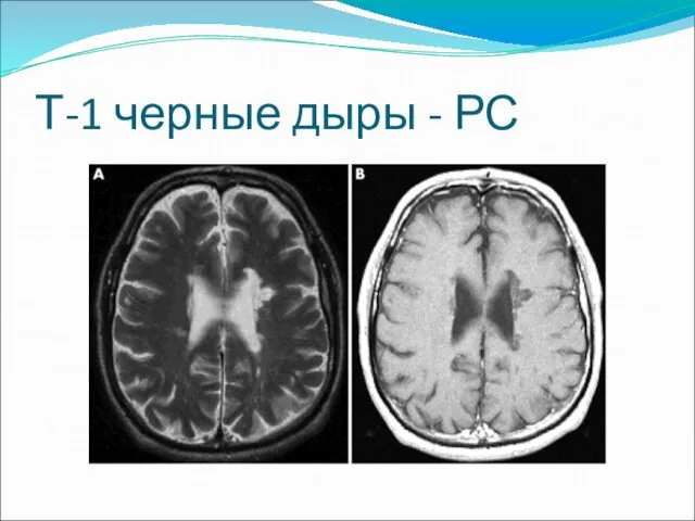 Т-1 черные дыры - РС