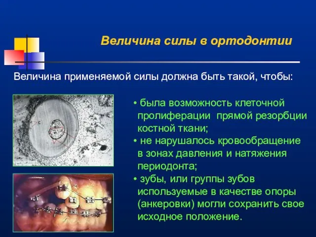 Величина силы в ортодонтии Величина применяемой силы должна быть такой, чтобы: