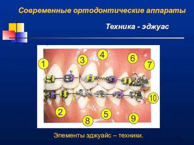 1 Современные ортодонтические аппараты Техника - эджуас Элементы эджуайс – техники.