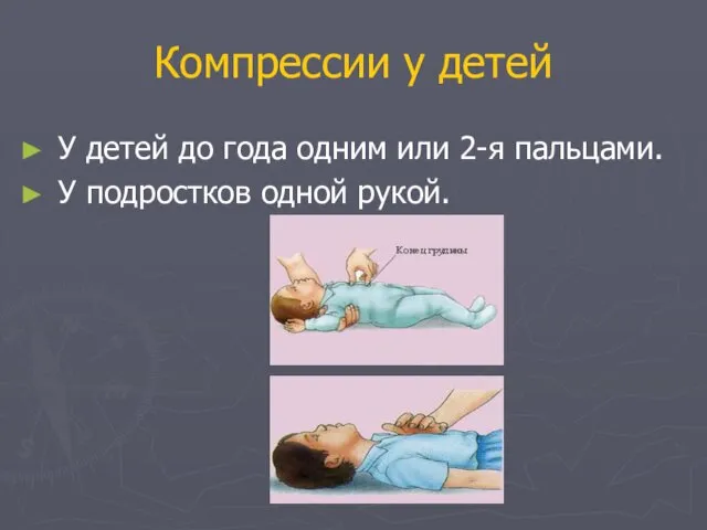 Компрессии у детей У детей до года одним или 2-я пальцами. У подростков одной рукой.