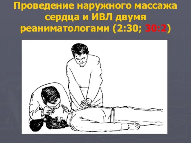 Проведение наружного массажа сердца и ИВЛ двумя реаниматологами (2:30; 30:2)