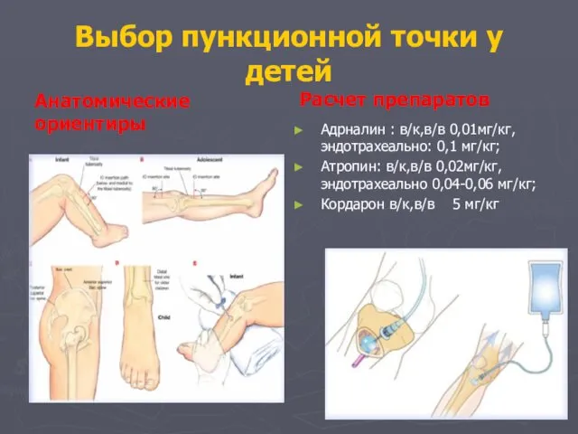 Выбор пункционной точки у детей Анатомические ориентиры Расчет препаратов Адрналин :