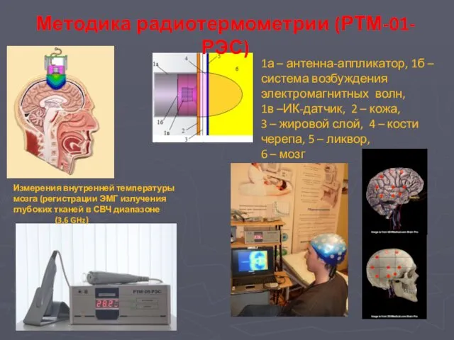 1а – антенна-аппликатор, 1б –система возбуждения электромагнитных волн, 1в –ИК-датчик, 2