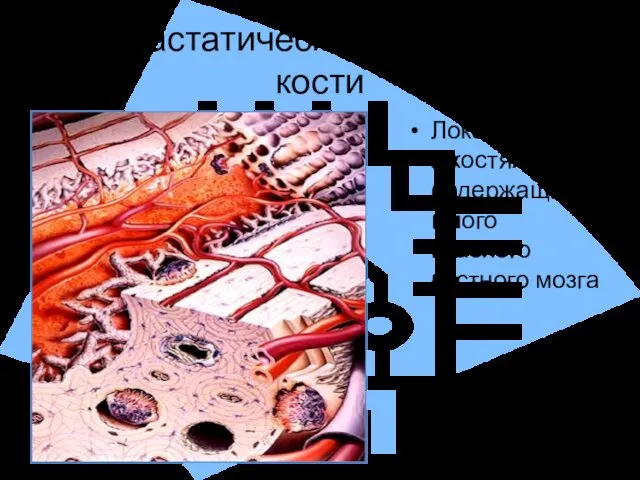 Метастатическое поражение кости Локализуется в костях содержащих много красного костного мозга