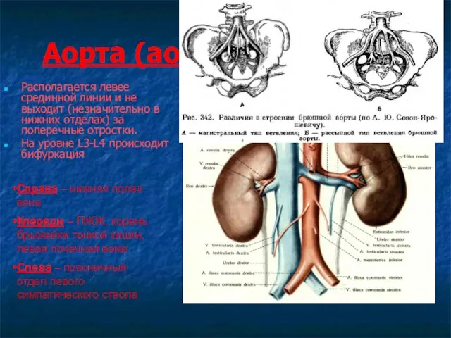 Аорта (aorta abdominalis) Располагается левее срединной линии и не выходит (незначительно