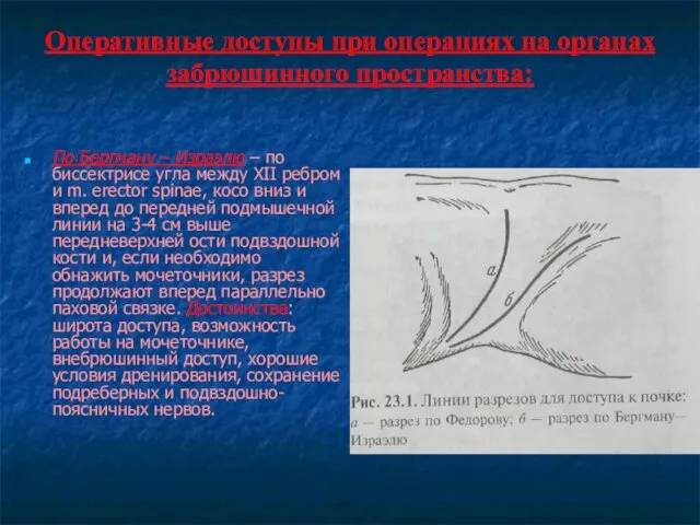 Оперативные доступы при операциях на органах забрюшинного пространства: По Бергману –