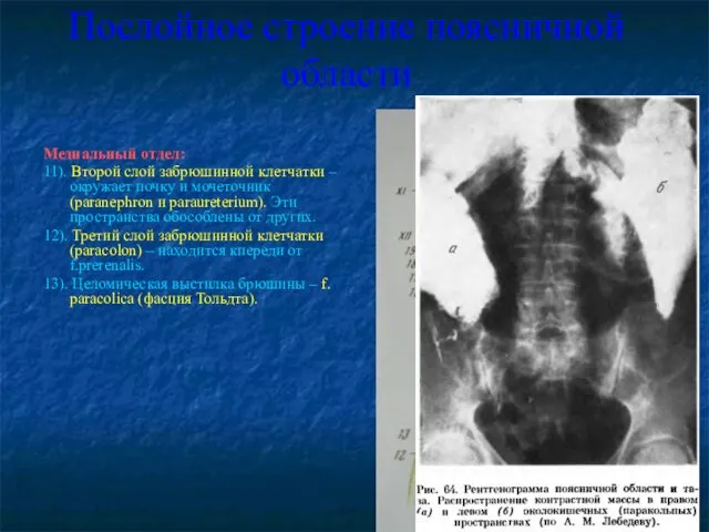 Послойное строение поясничной области Медиальный отдел: 11). Второй слой забрюшинной клетчатки