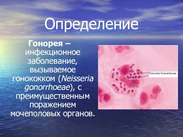 Определение Гонорея – инфекционное заболевание, вызываемое гонококком (Neisseria gonorrhoeae), с преимущественным поражением мочеполовых органов.