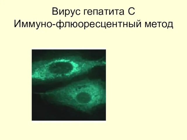 Вирус гепатита С Иммуно-флюоресцентный метод