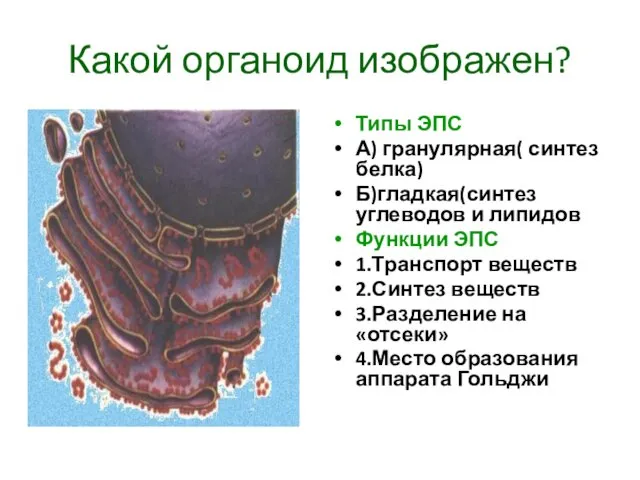 Какой органоид изображен? Типы ЭПС А) гранулярная( синтез белка) Б)гладкая(синтез углеводов