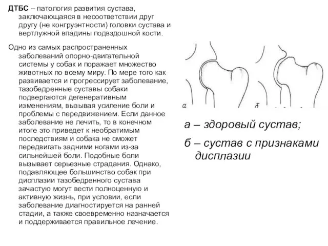 ДТБС – патология развития сустава, заключающаяся в несоответствии друг другу (не