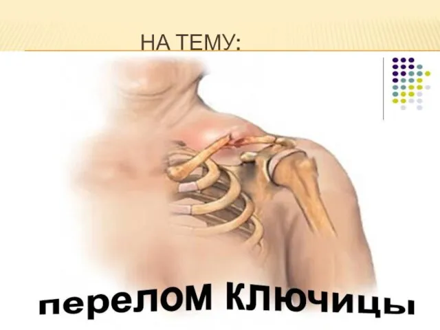 НА ТЕМУ: