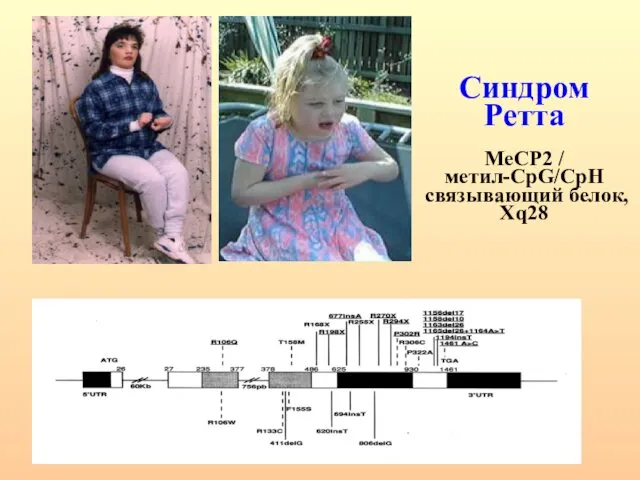 Синдром Ретта MeCP2 / метил-CpG/CpH связывающий белок, Xq28