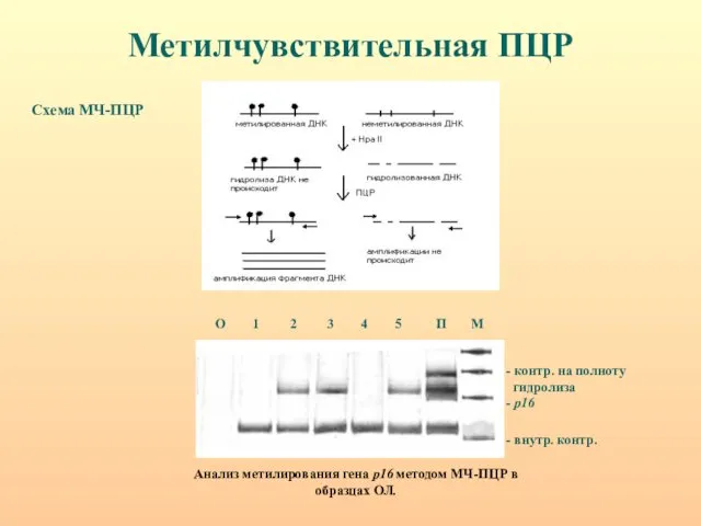 Метилчувствительная ПЦР Схема МЧ-ПЦР Анализ метилирования гена р16 методом МЧ-ПЦР в образцах ОЛ.