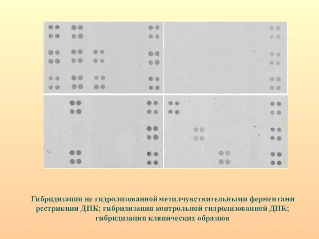 Гибридизация не гидролизованной метилчувствительными ферментами рестрикции ДНК; гибридизация контрольной гидролизованной ДНК; гибридизация клинических образцов