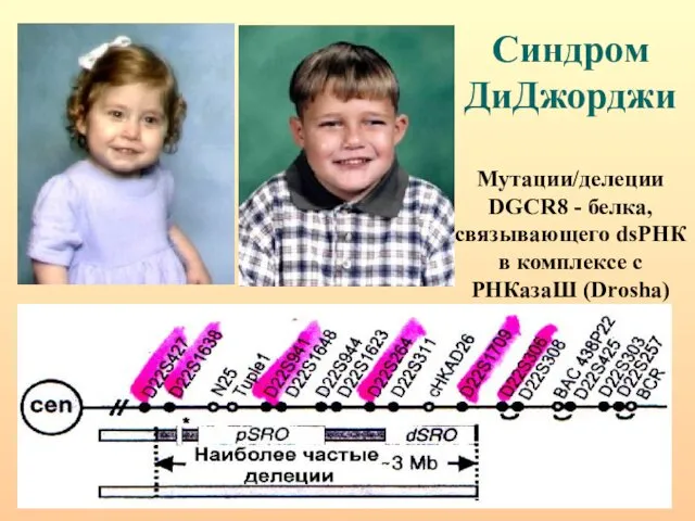 Синдром ДиДжорджи Мутации/делеции DGCR8 - белка, связывающего dsРНК в комплексе с РНКазаШ (Drosha)