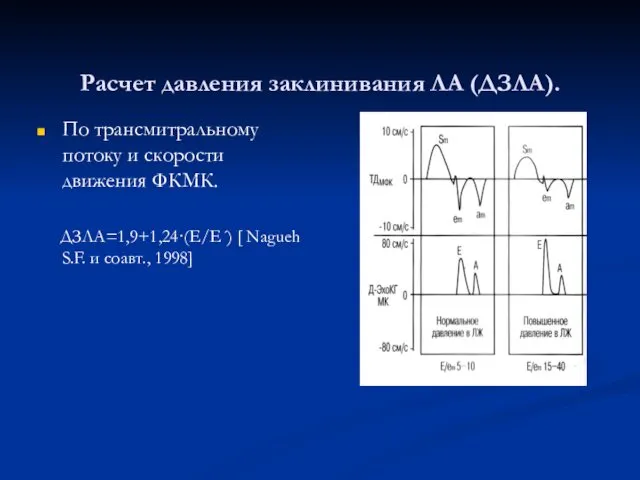 Расчет давления заклинивания ЛА (ДЗЛА). По трансмитральному потоку и скорости движения