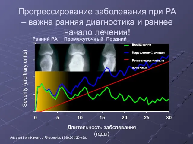 Severity (arbitrary units) 0 Длительность заболевания (годы) 5 10 15 20