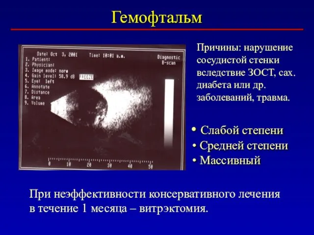 Гемофтальм Слабой степени Средней степени Массивный Причины: нарушение сосудистой стенки вследствие