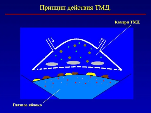 Принцип действия ТМД. Камера ТМД Глазное яблоко