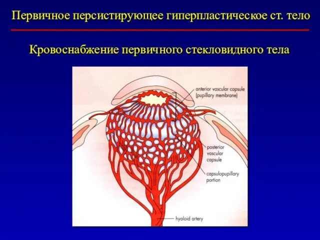 Первичное персистирующее гиперпластическое ст. тело Кровоснабжение первичного стекловидного тела