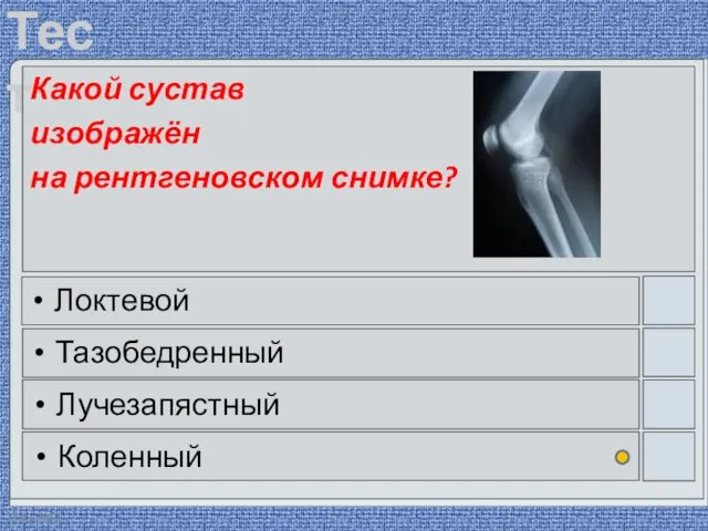 22.03.2016 Какой сустав изображён на рентгеновском снимке? Локтевой Тазобедренный Лучезапястный Коленный