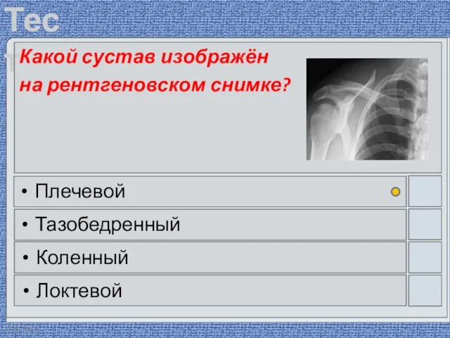 22.03.2016 Какой сустав изображён на рентгеновском снимке? Плечевой Тазобедренный Коленный Локтевой