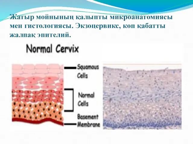 Жатыр мойнының қалыпты микроанатомиясы мен гистологиясы. Экзоцервикс, көп қабатты жалпақ эпителий.