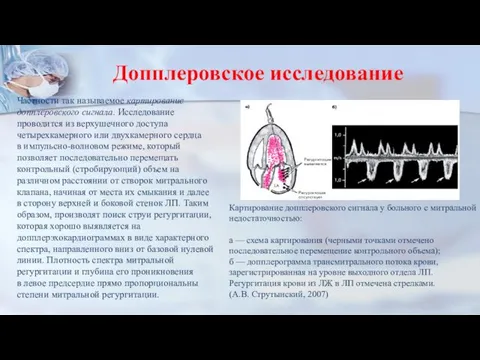 Допплеровское исследование Частности так называемое картирование допплеровского сигнала. Исследование проводится из