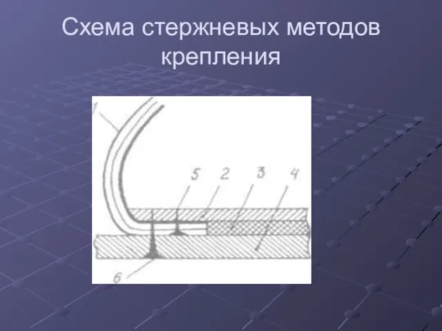 Схема стержневых методов крепления