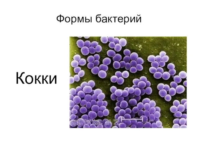 Формы бактерий Кокки
