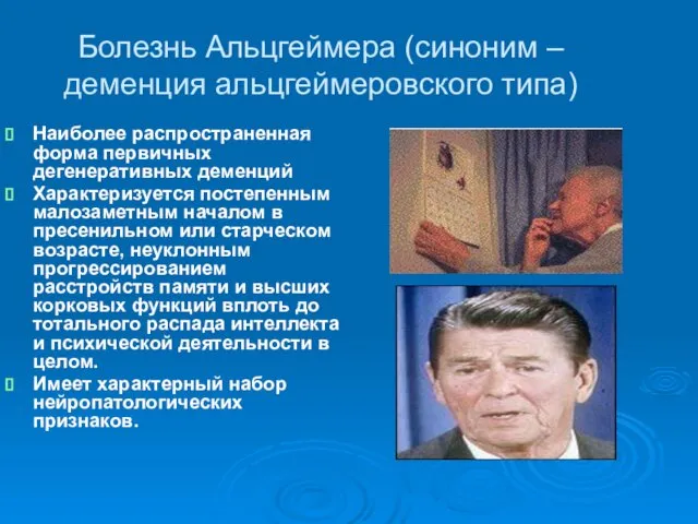 Болезнь Альцгеймера (синоним –деменция альцгеймеровского типа) Наиболее распространенная форма первичных дегенеративных