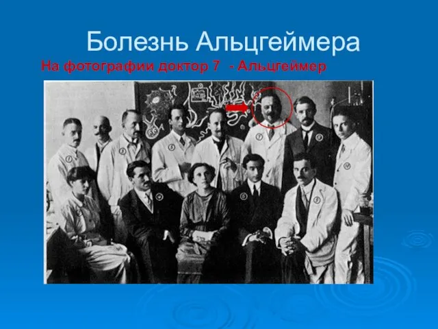 Болезнь Альцгеймера На фотографии доктор 7 - Альцгеймер