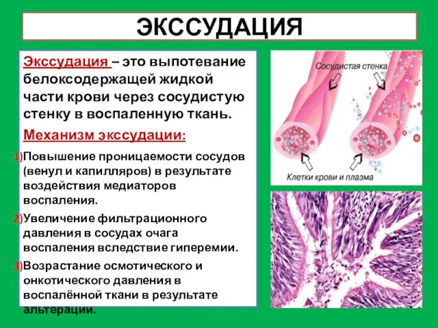 ЭКССУДАЦИЯ Экссудация – это выпотевание белоксодержащей жидкой части крови через сосудистую