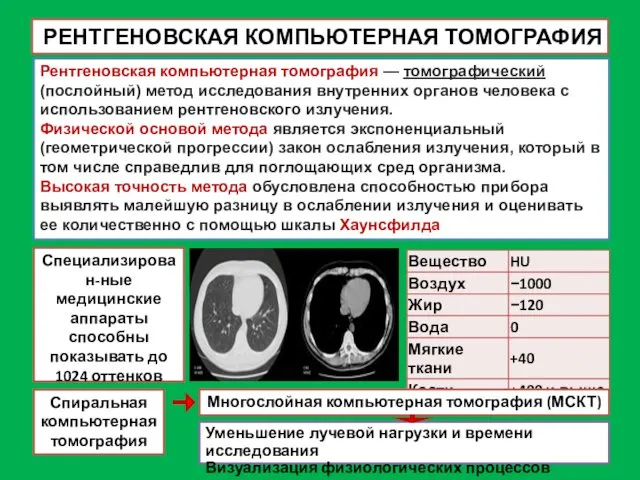 РЕНТГЕНОВСКАЯ КОМПЬЮТЕРНАЯ ТОМОГРАФИЯ Рентгеновская компьютерная томография — томографический (послойный) метод исследования