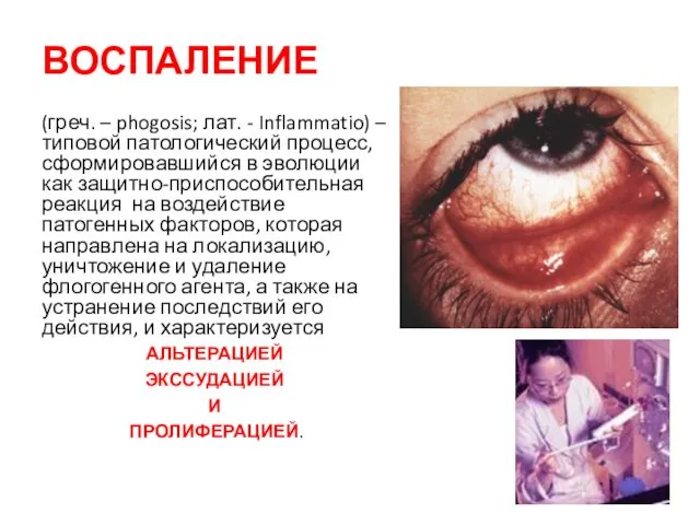 ВОСПАЛЕНИЕ (греч. – phogosis; лат. - Inflammatio) – типовой патологический процесс,