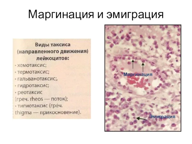 Маргинация и эмиграция Маргинация Эмиграция