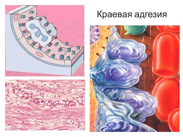 Краевая адгезия