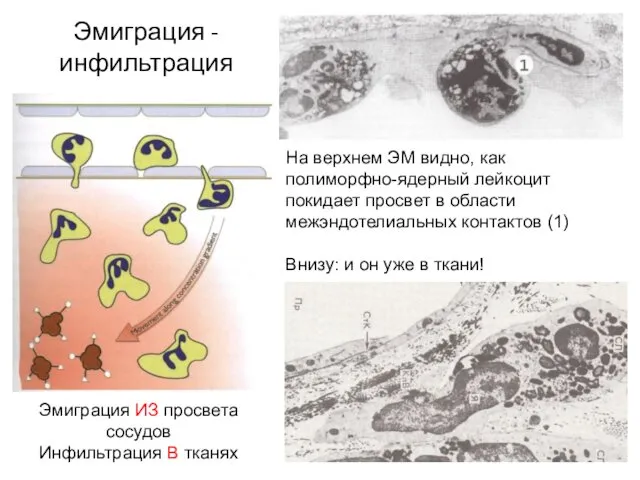 Эмиграция - инфильтрация Эмиграция ИЗ просвета сосудов Инфильтрация В тканях На