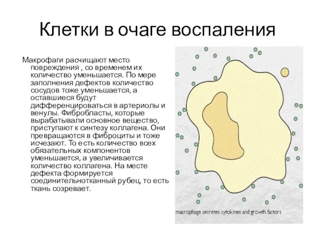 Клетки в очаге воспаления Макрофаги расчищают место повреждения , со временем