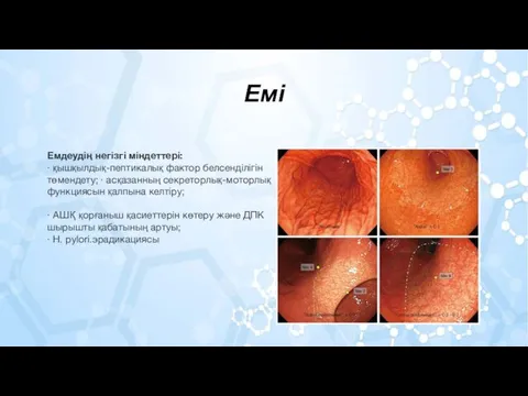 Емі Емдеудің негізгі міндеттері: · қышқылдық-пептикалық фактор белсенділігін төмендету; · асқазанның