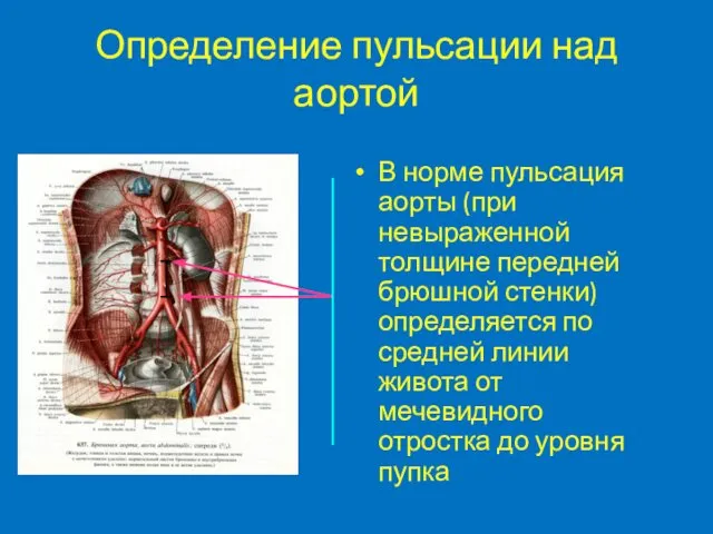 Определение пульсации над аортой В норме пульсация аорты (при невыраженной толщине