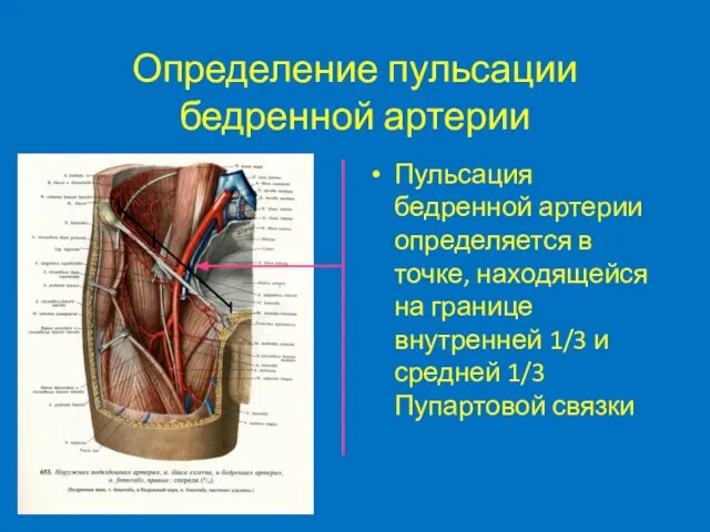 Определение пульсации бедренной артерии Пульсация бедренной артерии определяется в точке, находящейся