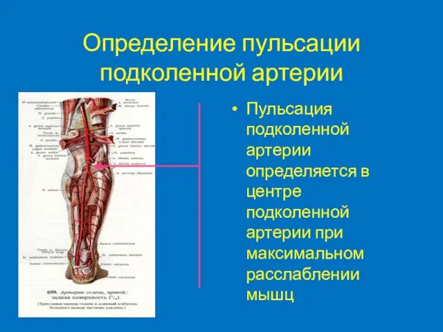 Определение пульсации подколенной артерии Пульсация подколенной артерии определяется в центре подколенной артерии при максимальном расслаблении мышц